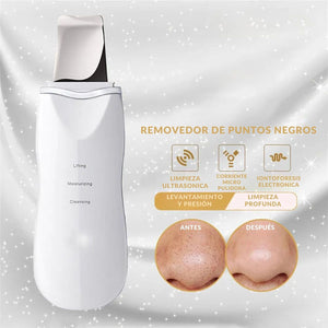 UltraGlow™ I Paleta Ultrasónica Facial