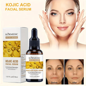 Sérum Facial Ácido Kójico de KORMESIC™ | Potente Desmanchador con Niacinamida